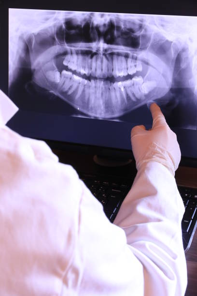 Best Emergency Root Canal Therapy in Wingate, NC